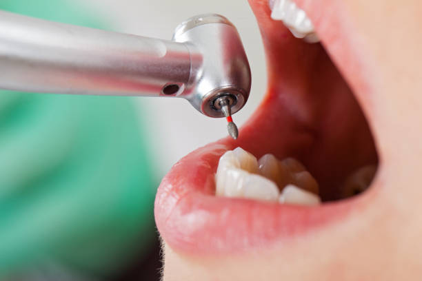 Best Emergency Tooth Extraction  in Lipscom, AL